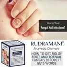 Rudramani Foot Anti Fungal Infection Fungus Repair Dry Crack treatment Cream