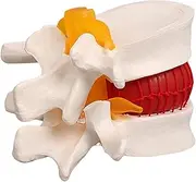 Generic Herniated Disc Model Spine Model for The Learning School