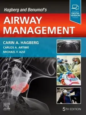 Hagberg and Benumof’s Airway Management