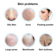 Oil Absorbing Face Roller Reusable Double Headed Oil Control Volcanic Skin R WTD