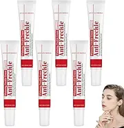 Whitening Freckle Cream, Moisturizing Anti-blemish Cream with Vitamin C, Anti-wrinkle Pigmentation Removal for Face, Against Dark Spots, Melasma, Melanin and Pigment Spots, Even Skin Tone (6pcs)