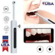 Wireless WiFi Oral Dental Endoscope HD Oral Intraoral Endoscope Camera LED Light