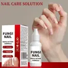 Toenail Fungus Super Strengthening Serum Nail Care Solution Cracking Nails Serum
