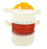Anatomical Herniated Lumbar Vertebrae Disc Prolapse Model Human Medical Anatomy
