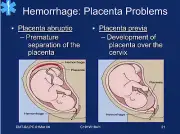 80 Slide EMS EMT EMT-B Obstetric & Gynecologic Emergiencies PowerPoint on CD