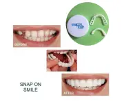 2Pcs/Set Teeth Denture Upper Snap on Smile Natural Flex Denture Cover Teeth Cosmetic Veneers for Dental Clinic