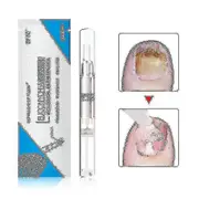 3ml Fungus Treatment Nail Oil Pen Anti-fungal Nail Cuticle Remover