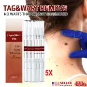 5X Common and Plantar Moles-Off Wartsoff Remover, WipeOff Tags&Moles Remover US