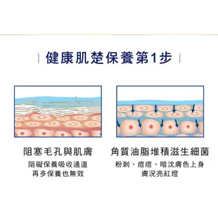 碧歐斯 全效賦活深層去角質凝膠（水潤配方） 60g 去角質 臉部去角質 蜂王漿 臉用去角質