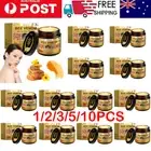 1/2/3/5/10PCS Bee Venom Skin Treatments Cream Natural Skin Tag Removal Cream 60g