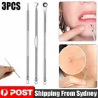 3x Blackhead Remover Tool Black Spots Needles Pore Cleanser Extractor Tool Kit