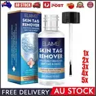 Skin-Tag-Remover-Kit, Mole & Wart-Remover Liquid, Fast-Acting Skin-Tag-Remover