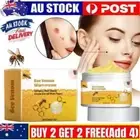 Bee Venom Skin Tag Removal Treatment Cream Body Care Mole Corn Wart Remover`