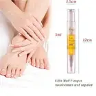 Fungal Toe Fungus Nail Treatment Anti-Onychomycosis Infection