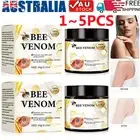 1-5x Bee-Venom Skin Tag Removal Treatment Cream Body Care Mole Corn Wart Remover