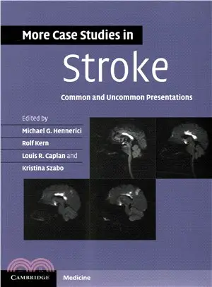 More Case Studies in Stroke ― Common and Uncommon Presentations