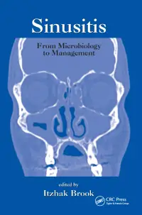 在飛比找博客來優惠-Sinusitis: From Microbiology T