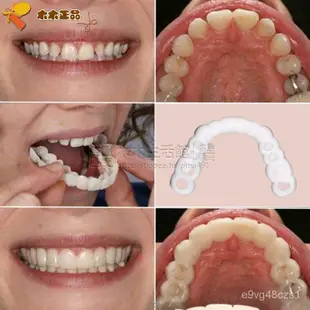 《免運》✨✨臨時牙套門牙遮蓋假牙套仿真美容可脫卸隱形矯正器護齒美白牙套tl9S