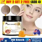 Bee Venom Skin Tag Removal Treatment Cream For Body Care Mole Corn Skin Wart