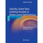 VARICELLA-ZOSTER VIRUS EPITHELIAL KERATITIS IN HERPES ZOSTER OPHTHALMICUS: IN VIVO MORPHOLOGY IN THE HUMAN CORNEA