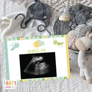 Baby Shower Baby Boy Ultrasound Guess Game Springtime Garden Bugs