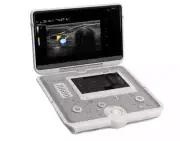 ESAOTE MyLab Sigma Ultrasound with 2 probes (New and boxed)