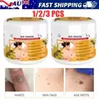 1-3pcs Bee-Venom Mole & Wart Treatment-Cream Bee-Venom Wart and Tag Remover