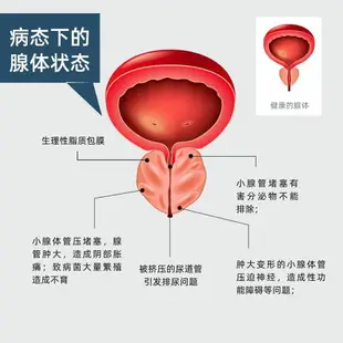 前列腺按摩器 超級光前列腺治療器增生肥大坐灸理療家用尿頻紅光治療儀長生之光