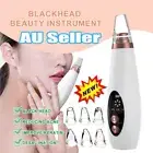 Electric Blackhead Remover Facial Skin Pore Cleaner Face Vacuum Derma Suction BY