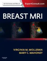 在飛比找博客來優惠-Breast MRI