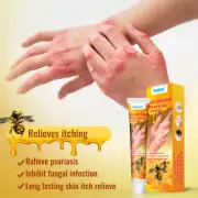 Dermatitis Eczema Anti Itching Bee Venom Psoriasis Cream Skin Pruritus Ointment