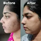 Good Bye Blemishes Pigmentation & Dark Spot Removal Cream Brighten Skin Tone 50g