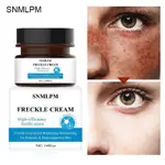 POWERFUL WHITENING CREAM FACE TO REMOVE FRECKLES DARK SPOTS