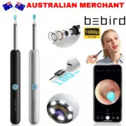 Wireless Ear Wax Remover 1080P HD Camera Endoscope Spoon Pick Cleaner Best