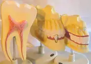 3 deciduous permanent teeth tooth dental dentist office anatomical model New