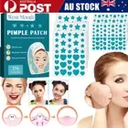 Stars Hearts Acne Pimple Patches Stickers Facial Removal Repair Hydrocolloid
