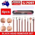 Blackhead Remover Tool Pimple Popper Tool Black Head Extractor Set Stainless