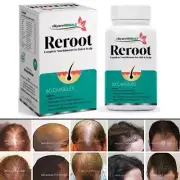 DHT Blocker Hair Growth Supplement High Potency Biotin & Saw Palmetto 60 Capsule