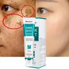 20ml Dark Spot Remover Whitening Freckle Cream for private area Nourishes Skin