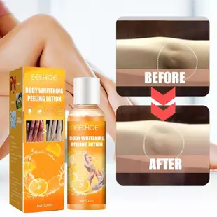 👍Whitening Peel Peeling Gel Skin Peeling Mask Fnger Knee Arm