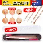 Blackhead Pimple Remover Popper Extractor Black Head Stainless Steel Tools Set