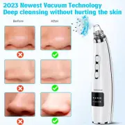 2023 Best Blackhead Vacuum: Upgraded Pore Cleaner and Acne Extractor Kit