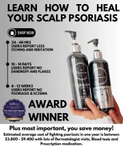 Scalp & Body Care For Your: Psoriasis, Eczema, Itching, Sores, Scabs & Dandruff - 10 Minute Miracle - Mega Bundle, SMALL BOTTLES 250ML