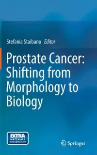 在飛比找博客來優惠-Prostate Cancer: Shifting from