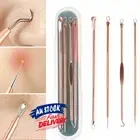 4Pcs Blackhead Whitehead Pimple Spot Comedone Extractor Remover Cleaner Kit New
