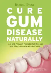 Cure Gum Disease Naturally: Heal Gingivitis and Periodontal Disease with Whole