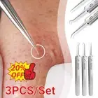 Pimple Remover Tool Kit Blackhead Extractor Acne Spot Popper Tweezers