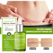 Scar Repair Serum for All Scars and Stretch Marks Advanced Formula&