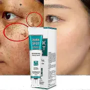2025 Remover For Face, Corrector Cream, Cream Melasma Remover Fade Out Precipitate 1pcs
