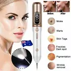 LCD Laser Plasma Pen Mole Removal Dark Spot Remover Skin Wart Tag Remover AU